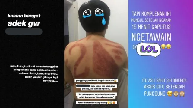 Dikerokin Tukang Urut, Punggung Pria ini Diarsir Nomor Urut Capres. Kocak, Dikira Baliho Kali~ 3
