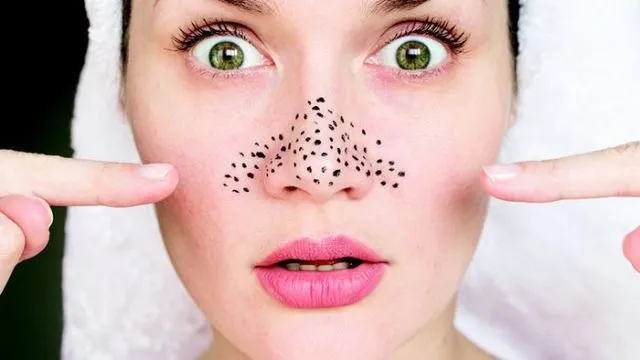 7 Fakta Pore Pack yang Justru Sering Dibilang Bikin Komedo, Benarkah? 9