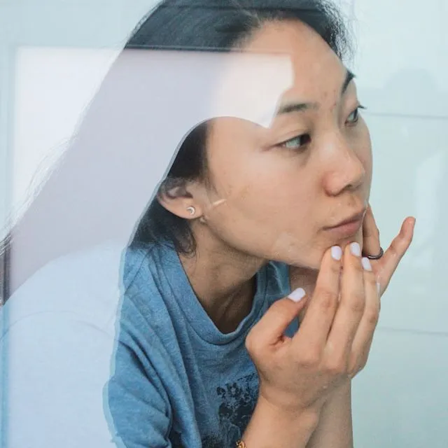 Apa itu Fungal Acne? Pengertian dan Cara Mengatasinya 10