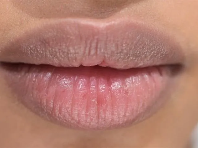6 Khasiat Madu untuk Bibir, Jadi Pengganti Lip Balm! 9