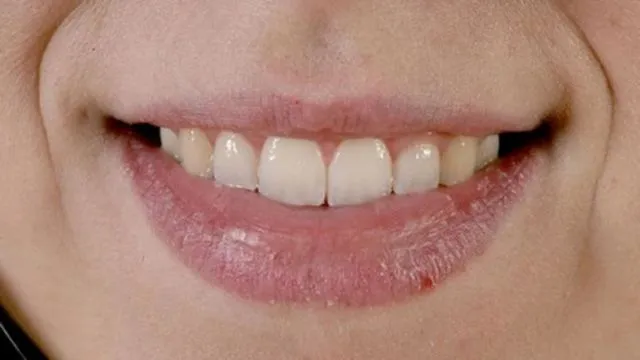6 Khasiat Madu untuk Bibir, Jadi Pengganti Lip Balm! 7
