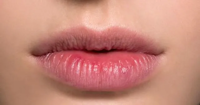6 Khasiat Madu untuk Bibir, Jadi Pengganti Lip Balm! 11
