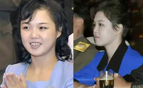 5 Potret Gaya Istri Kim Jong Un dari Dulu Hingga Kini. Salut Sama Karakternya yang Elegan! 10