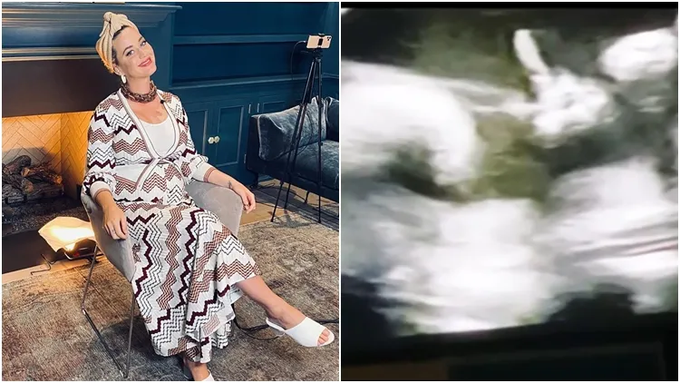 USG Calon Bayinya yang Ada di Kandungan, Katty Perry Kaget Lihat Apa yang Ditunjukkan Putrinya