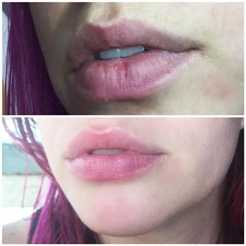 4 Keuntungan Buatmu yang Suka Pakai Lip Balm Berwarna. Natural tapi Manis! 6