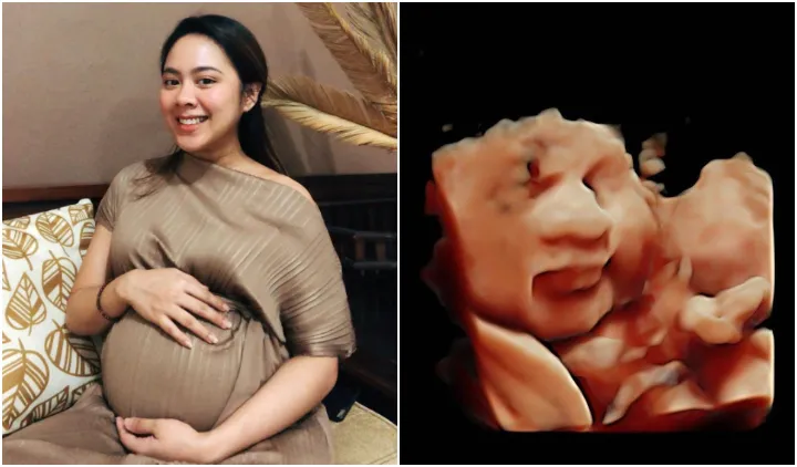 Belum Lama Jadi Mualaf, Marcell Darwin Belajar Azan Menjelang Kelahiran Anak Pertamanya 4