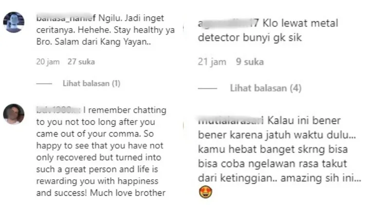 Sempat Trauma karena Kecelakaan, Hamish Daud Unggah Foto X-Ray Wajahnya. Ternyata Penuh Baut 6
