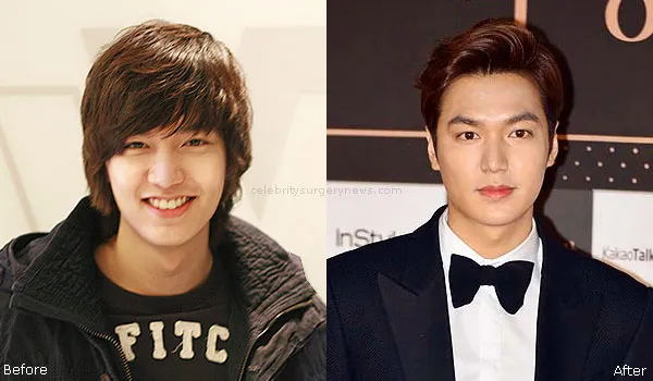 9 Penampilan Jadul Lee Min Ho yang Nggak Banyak Terekspos. Tetap Ganteng Nggak? 13