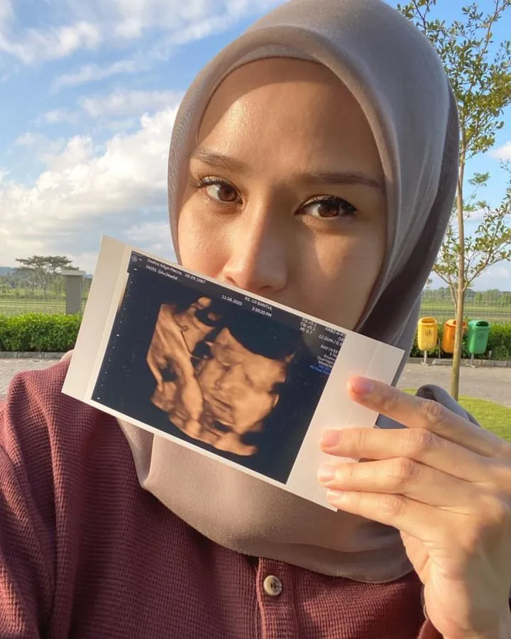 Pasrah Wajah Anak Ke-5 Mirip sang Suami Lagi, Anak Ke-3 Zaskia Mecca Malah Protes Lihat Hasil USG 4