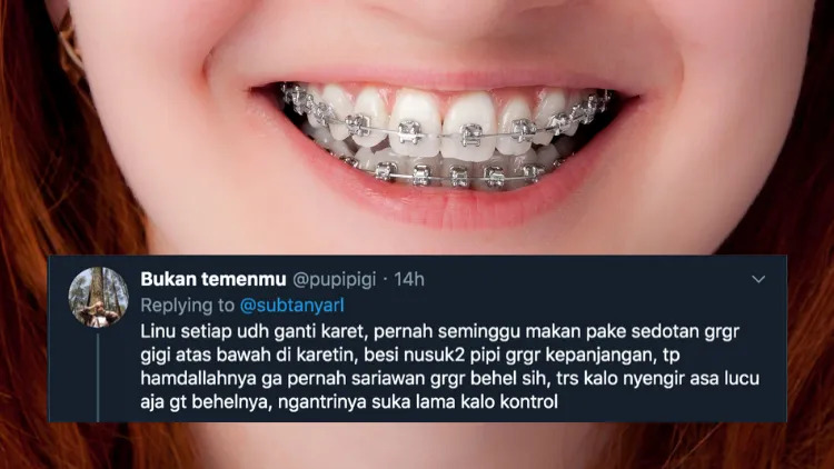 Suka Duka bagi Orang-Orang yang Pakai Behel. Jangan Kira Kawat Gigi Bisa Bikin Auto Cakep, Ya! 12