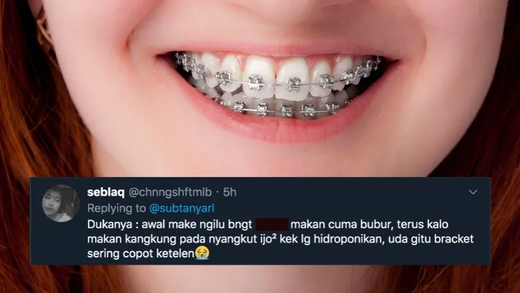 Suka Duka bagi Orang-Orang yang Pakai Behel. Jangan Kira Kawat Gigi Bisa Bikin Auto Cakep, Ya! 13