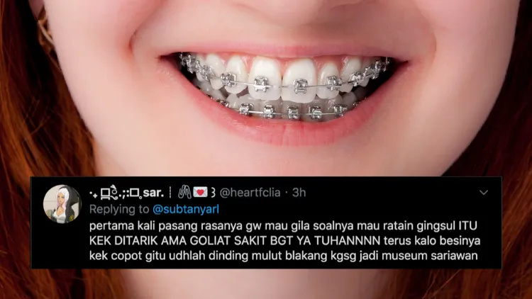Suka Duka bagi Orang-Orang yang Pakai Behel. Jangan Kira Kawat Gigi Bisa Bikin Auto Cakep, Ya! 14