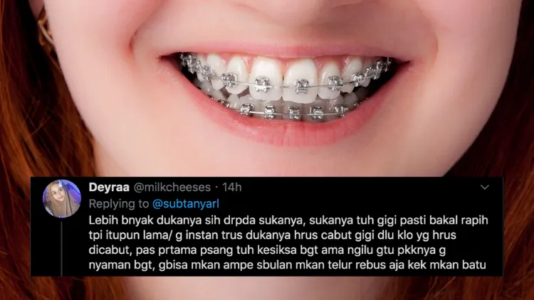 Suka Duka bagi Orang-Orang yang Pakai Behel. Jangan Kira Kawat Gigi Bisa Bikin Auto Cakep, Ya! 15