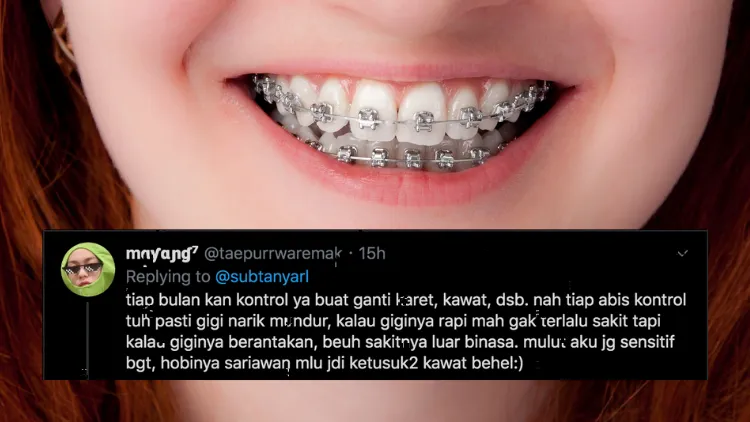 Suka Duka bagi Orang-Orang yang Pakai Behel. Jangan Kira Kawat Gigi Bisa Bikin Auto Cakep, Ya! 16