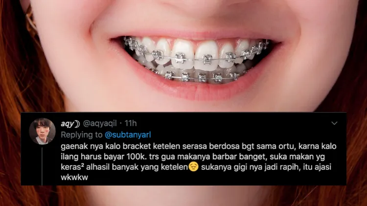Suka Duka bagi Orang-Orang yang Pakai Behel. Jangan Kira Kawat Gigi Bisa Bikin Auto Cakep, Ya! 17