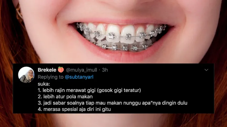 Suka Duka bagi Orang-Orang yang Pakai Behel. Jangan Kira Kawat Gigi Bisa Bikin Auto Cakep, Ya! 18
