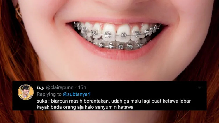 Suka Duka bagi Orang-Orang yang Pakai Behel. Jangan Kira Kawat Gigi Bisa Bikin Auto Cakep, Ya! 19