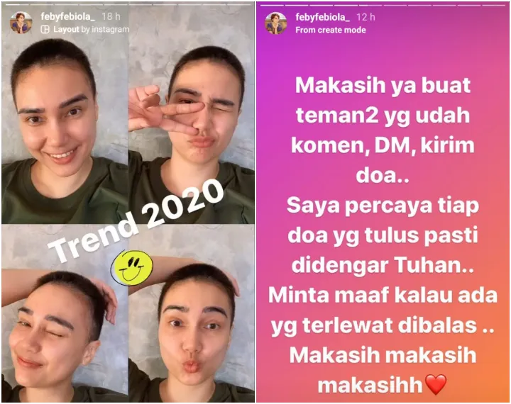 Lakukan Kemoterapi, Feby Febiola Pede dengan Rambut Cepak. Franky Sihombing Beri Pesan Romantis 2