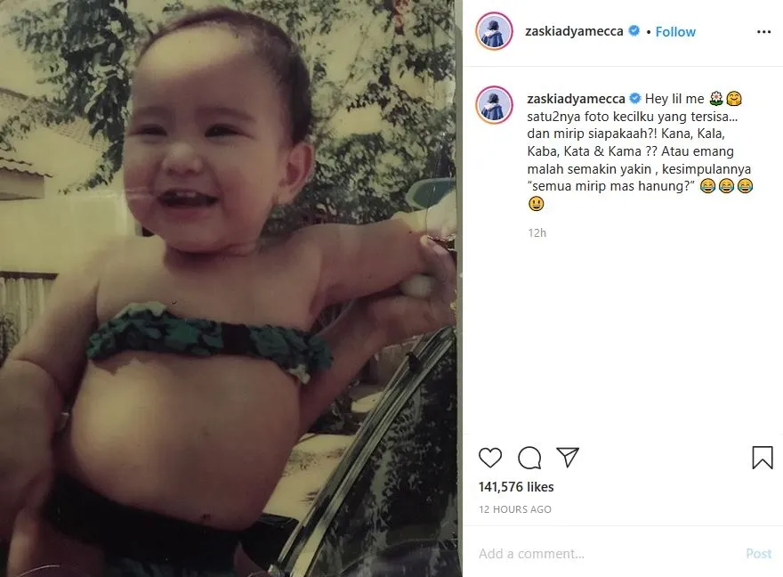 Posting Foto Waktu Bayi Biar Dibilang Mirip Anak, Zaskia Mecca Malah Lebih Mirip Keponakannya 3