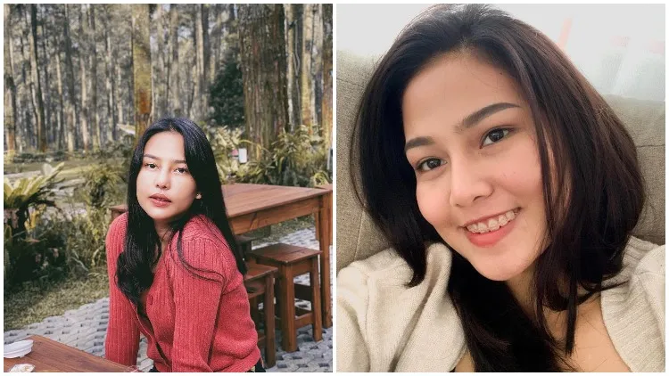 Dicecar Soal Operasi Hidung, Dara Arafah: Udah Minta Izin Orang Tua Sejak SMP 4