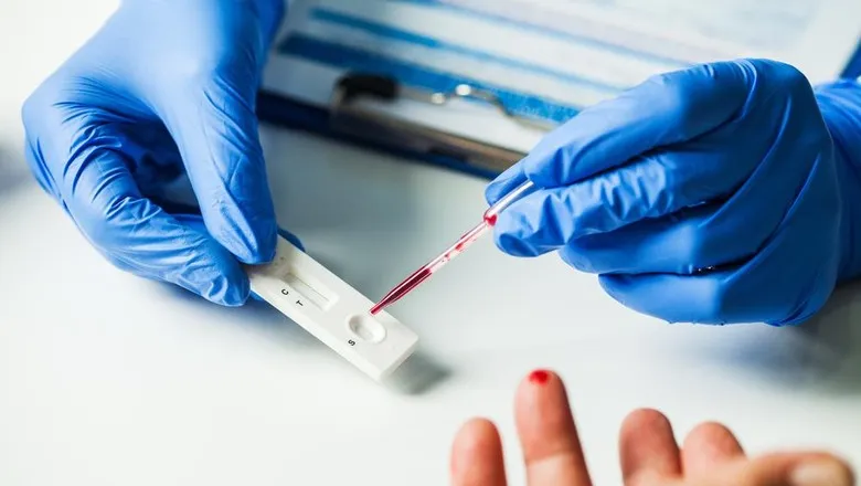 Mengenal Perbedaan 2 Jenis Tes Corona: Rapid Test dan PCR Test, Biar Nggak Bingung dan Salah Kaprah 4