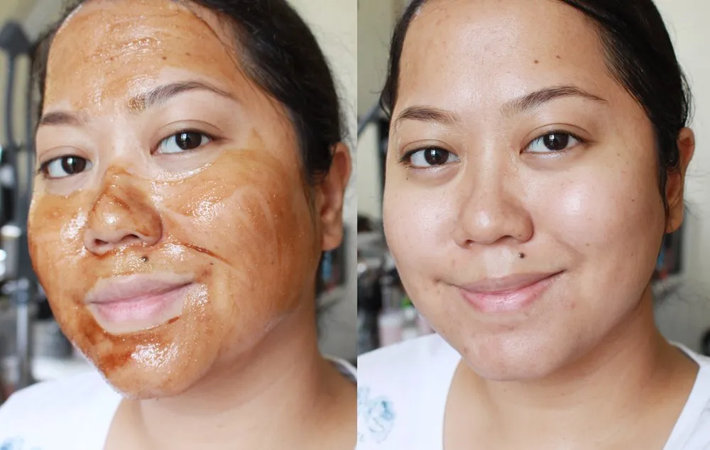 7 Racikan Masker Madu untuk Berbagai Masalah Kulit. Jerawat dan Pori-pori Besar Bisa Diatasi 18