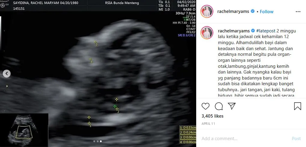 Hampir 9 Tahun Menikah Siri, ini Alasan Rachel Maryam Baru Ajukan Isbat Pernikahan Sekarang 4