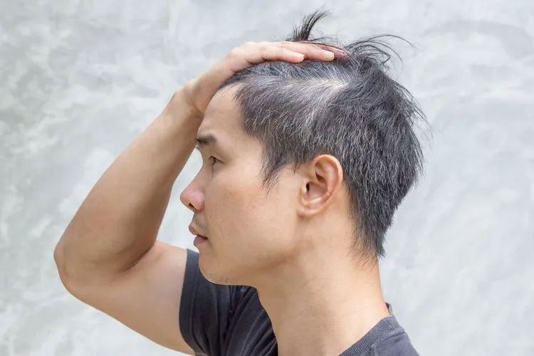 7 Mitos dan Fakta Tentang Rambut Uban. Memangnya Kalau Dicabut, Tumbuhnya Jadi Banyakan? 10