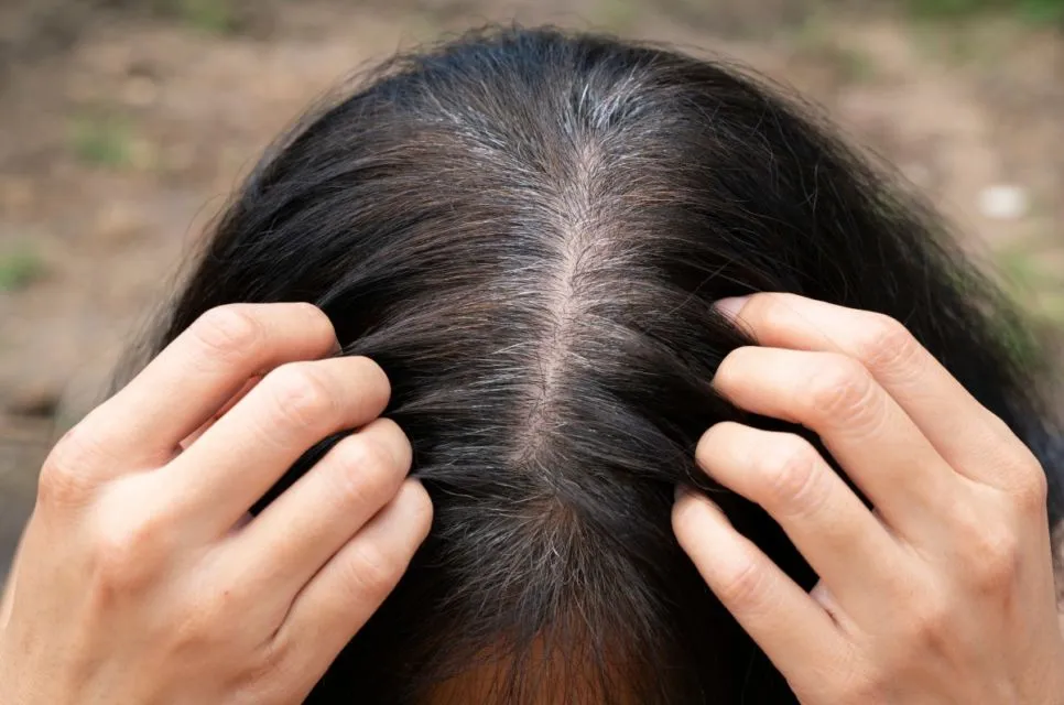 7 Mitos dan Fakta Tentang Rambut Uban. Memangnya Kalau Dicabut, Tumbuhnya Jadi Banyakan? 11