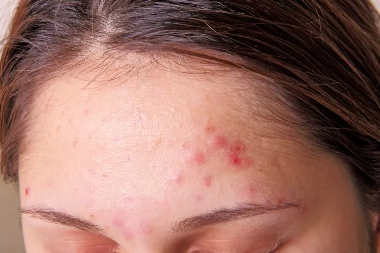 Rambut Berponi Memang Bikin Tingkat Kelucuan Cewek Bertambah sih, tapi Kadang Menyebalkan :( 11