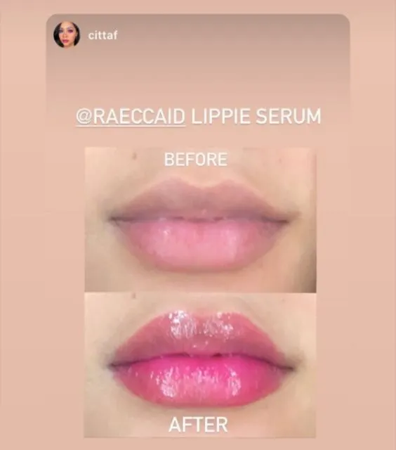 Viral Lip Serum yang Bisa Mengembalikan Warna Alami Bibir Seketika. Benarkah Sebagus Itu? 4