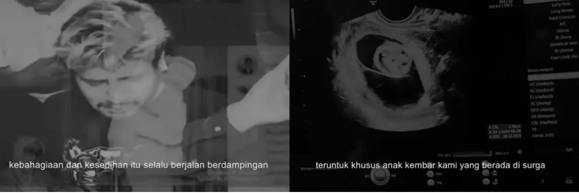 Kenang Setahun Kepergian Bayi Kembarnya, Ammar Zoni: Semoga Bertemu dan Bersama di Surga Nanti 3
