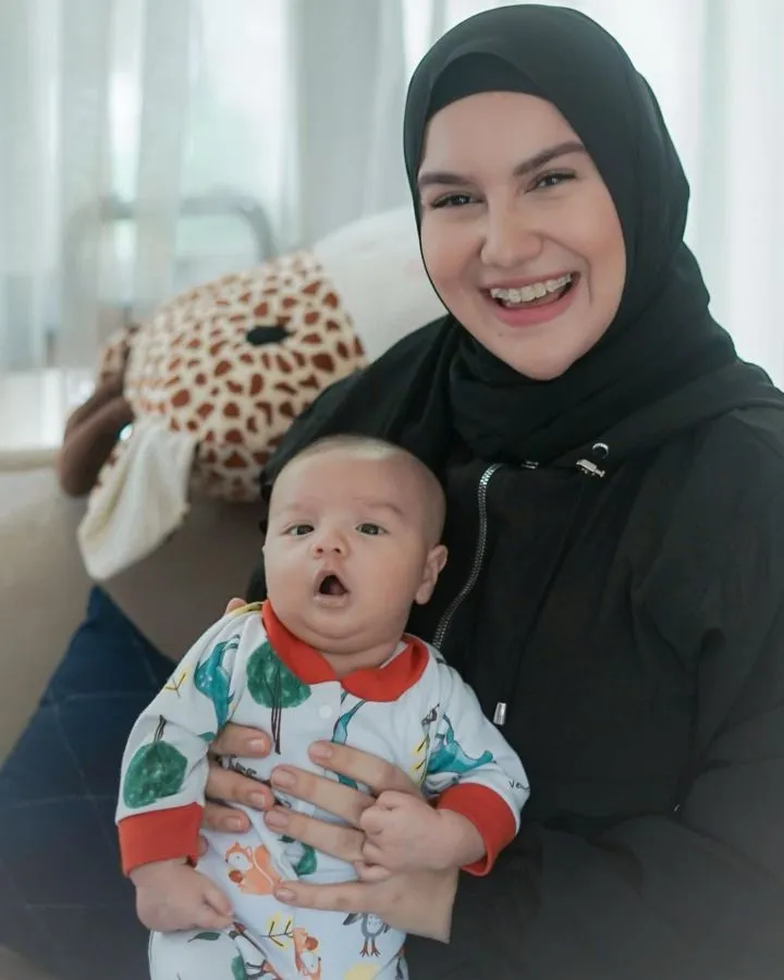 Terkenal karena Gigi Gingsulnya yang Bikin Makin Manis, Irish Bella Pilih Hilangkan Ciri Khasnya itu 4