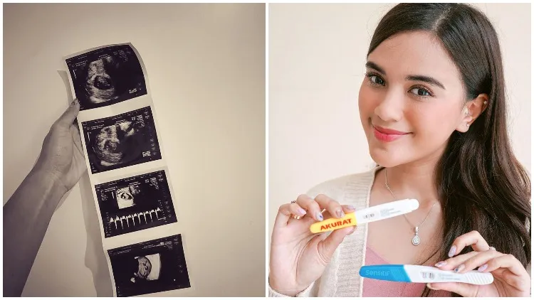 Umumkan Kehamilan, Audi Marissa Pamer Hasil USG dan Ceritakan Nikmatnya Momen Jadi Calon Ibu 3