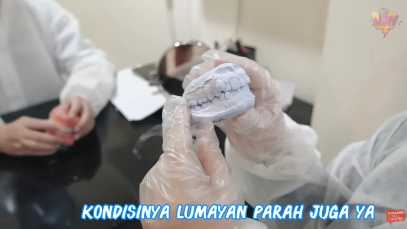 Terkenal karena Gigi Gingsulnya yang Bikin Makin Manis, Irish Bella Pilih Hilangkan Ciri Khasnya itu 3