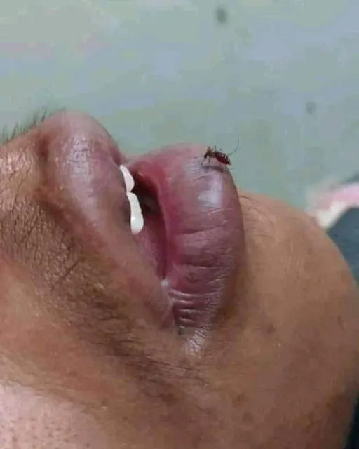 11 Potret Nyamuk Super yang Berani Tantang Maut. Nyalinya Gede Banget, Nggak Takut Mati! 15