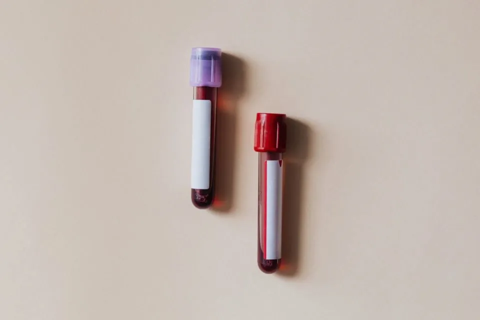 Gejala yang Sering Dianggap Darah Rendah, Padahal Bisa Jadi Itu Anemia 5