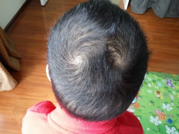 Anggapan Absurd Bocah dengan Jumlah Pusar Rambut Lebih dari Dua. Katanya Aktif Banget, Bun~ 6