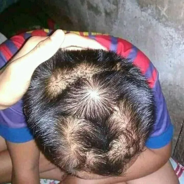 Anggapan Absurd Bocah dengan Jumlah Pusar Rambut Lebih dari Dua. Katanya Aktif Banget, Bun~ 5