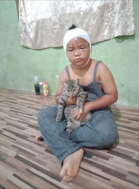 Viral Bocah Kecil Dicakarin Kucing, tapi Tetap Disayang-sayang. Budak Kocheng Sejak Dini~ 3