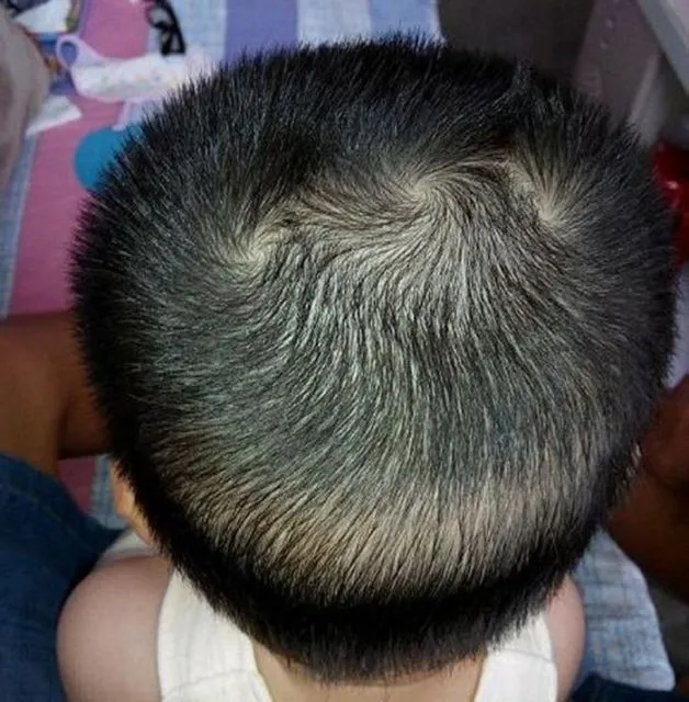 Anggapan Absurd Bocah dengan Jumlah Pusar Rambut Lebih dari Dua. Katanya Aktif Banget, Bun~ 4