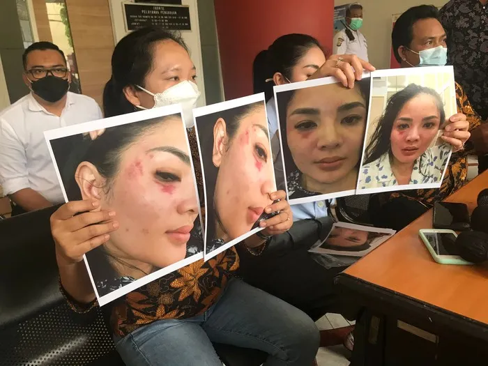 Beberkan Bukti KDRT yang Dilakukan Suami, Nindy Ayunda Menangis: Anak-anak dan Mendiang Ayah Tahu 3