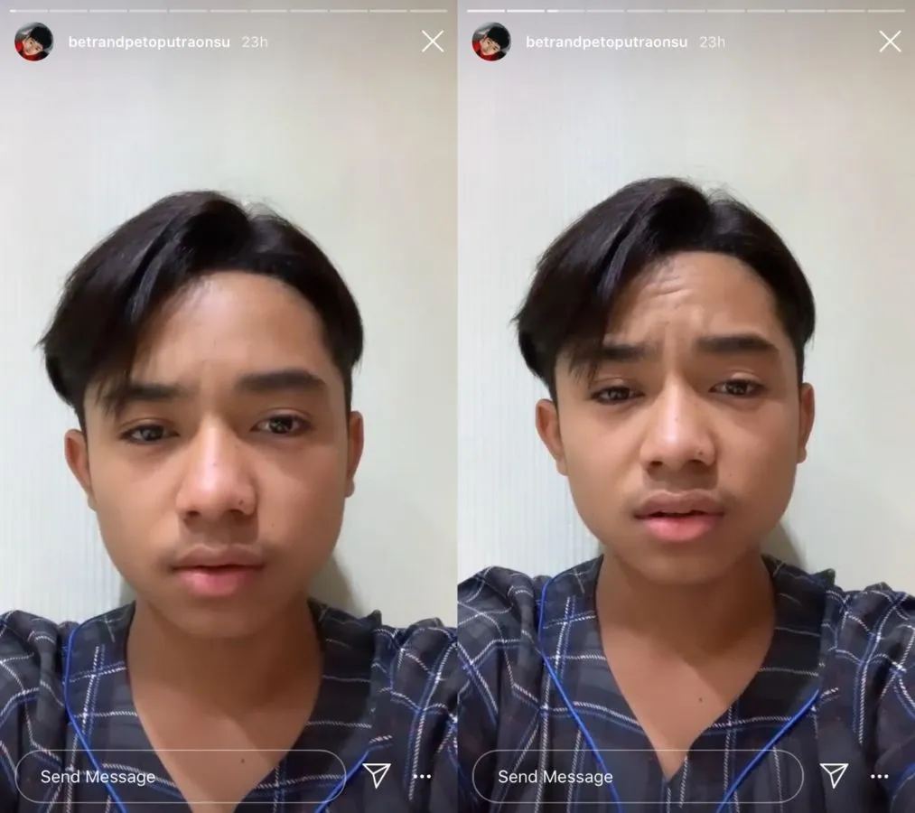 Dirinya Disebut Mendapat Perlakuan Berbeda bahkan Dimanfaatkan, Betrand Peto: Onyo Kecewa sama BXB 3