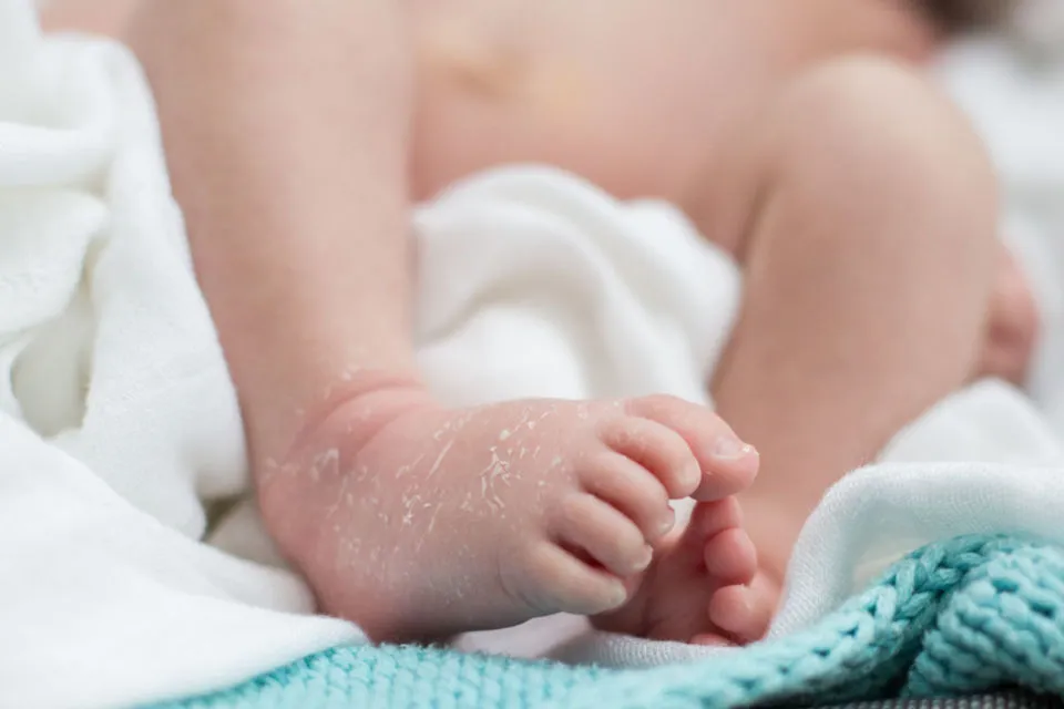 Kenali Tanda Kulit Sensitif dan Cara Mengatasinya pada Bayi 7