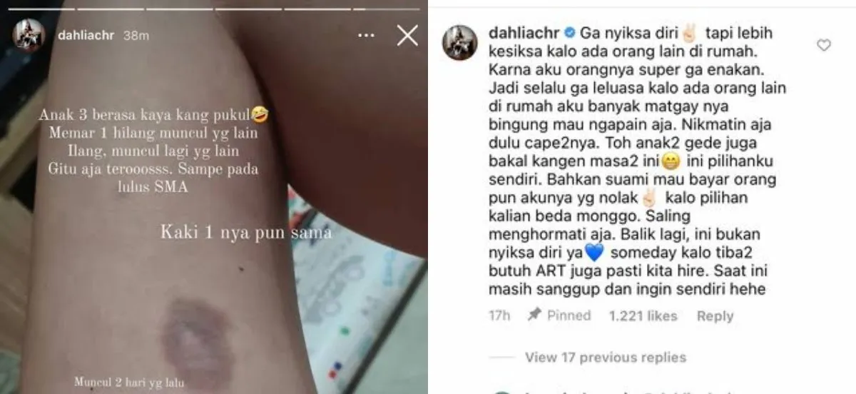 Tunjukkan Bekas Memar di Tubuh, Aksi Dahlia Poland Urus 3 Anak Tanpa ART Bikin Kagum 2