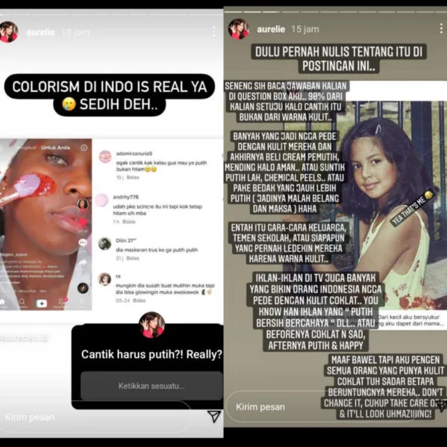 Pernah Didiskriminasi karena Warna Kulit, Aurelie Moeremans Tetap Bangga Miliki Kulit Kecokelatan 2