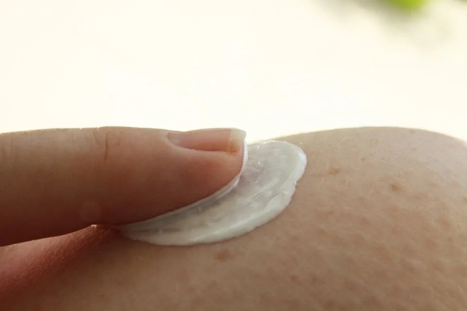 Perbedaan Kadas, Kurap dengan Panau ataupun Kudis 8 obat panu kadas kurap