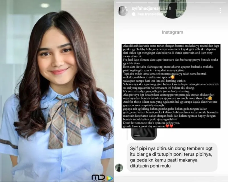 Diminta Tiruskan Pipi, Syifa Hadju: Kecantikan Perempuan Gak Cuma Diukur dari Wajahnya 2