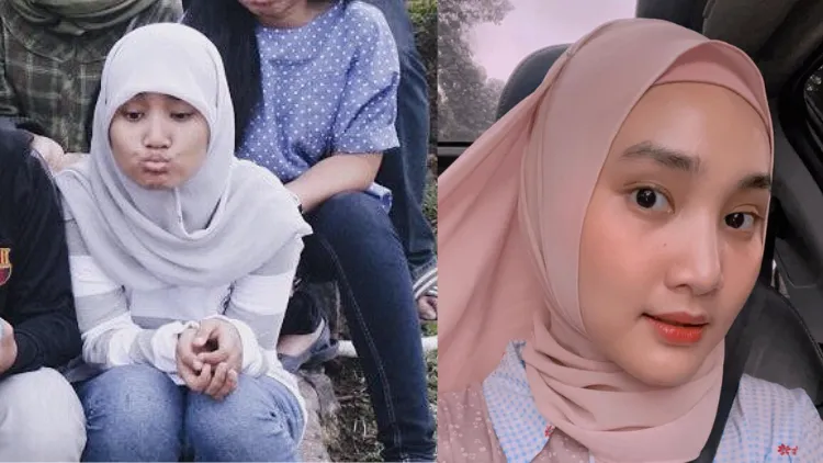 Foto Deretan Penyanyi Saat SMA vs Sekarang. Gemes Banget! 16