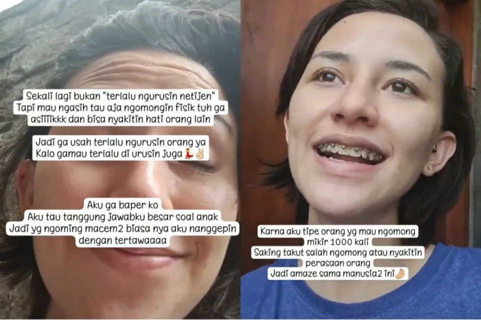 Wajahnya Dinyinyiri Warganet, Dahlia Poland: Kalau Aku Heboh Perawatan, Anak 3 Ditinggal sama Siapa? 3